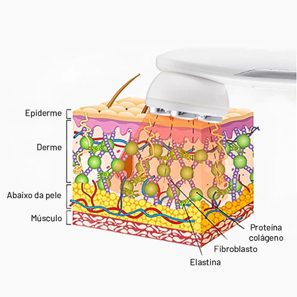 Aparelho de Radiofrequência Portátil FREMAS