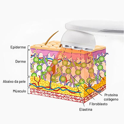 Aparelho de Radiofrequência Portátil FREMAS