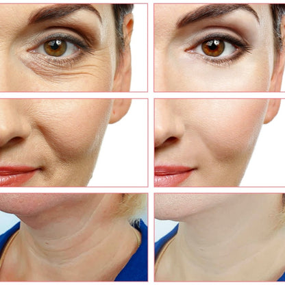 Aparelho de Radiofrequência Portátil FREMAS